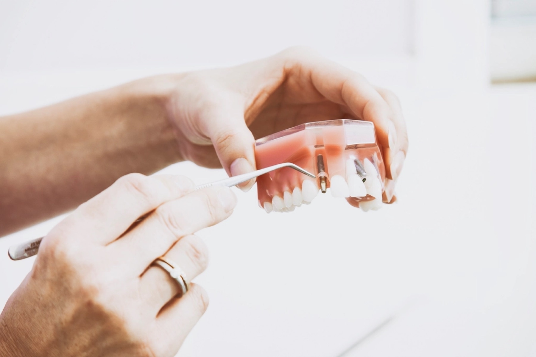 Hands holding a dental model with a probe